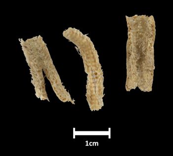 Media type: image;   Invertebrate Zoology OPH-3915 Description: Outside surface of ophiuroid arms with a scale bar.;  Aspect: labels